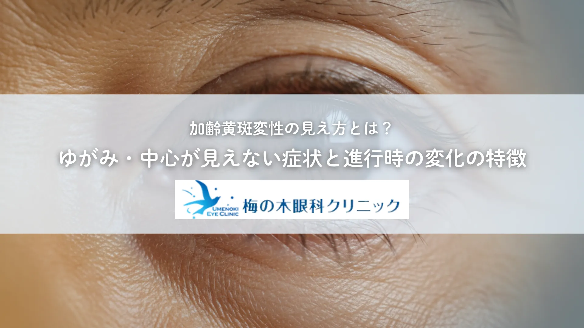 加齢黄斑変性の見え方とは？ゆがみ・中心が見えない症状と進行時の変化の特徴