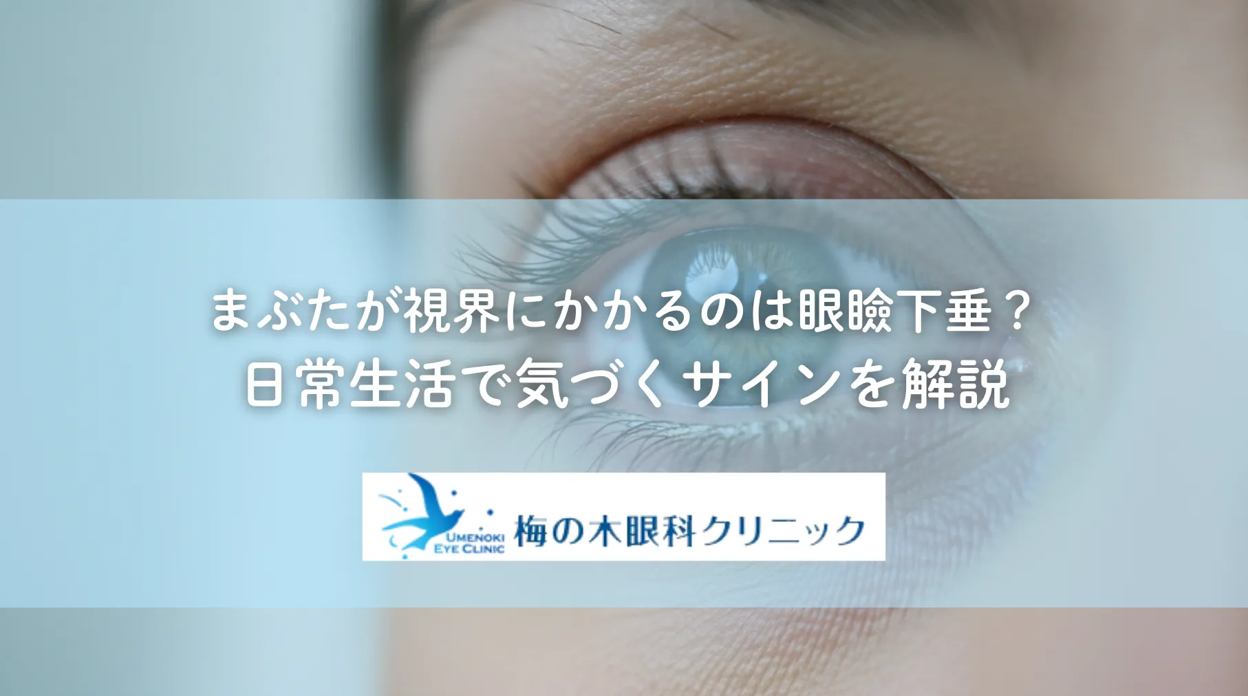まぶたが視界にかかるのは眼瞼下垂?日常生活で気づくサインを解説